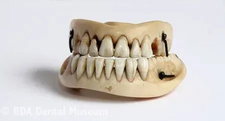 Set of skeletal Waterloo teeth.